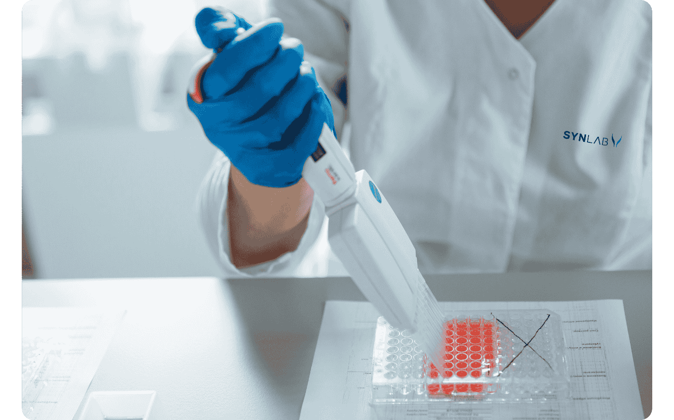 laboratorní vyšetření laboratoř